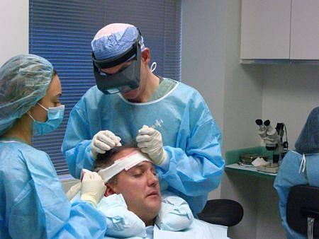 What is the Best Hair Transplant Procedure?