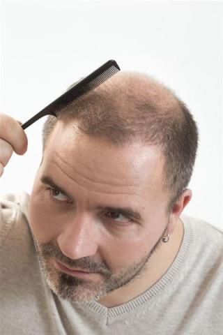 Scalp Flap Surgery
