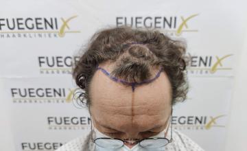 Dr. Munib Ahmad - From Mad Scientist to Rockstar - 2500g - Brown Curly Hair - FueGenix - The Netherlands [EXTREME CLOSE-UP'S]