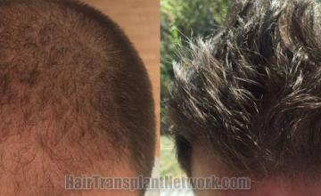 Front view - Before and after  