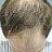 Baldframe